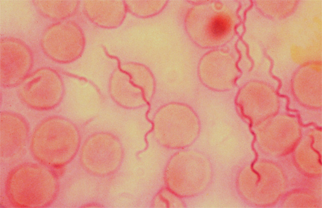 Borrelia-burgdorferi.jpg
