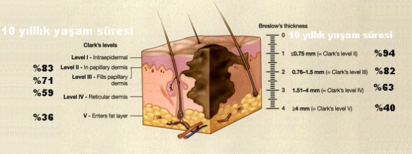 Melanoma-patolojisi.jpg
