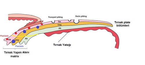 Trnak-pitting.jpg