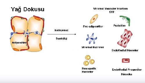 Yag-kok-hucre-tedavisi-7.jpg