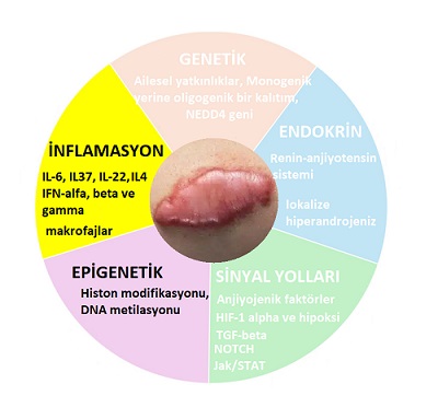 Keloidler Neden Oluşur