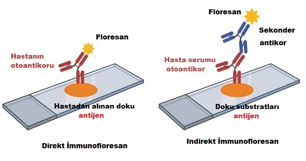 derinin_otoimmun_hastaliklari_immunfloresan_testler_2.jpg