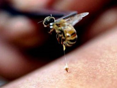 Arı ve Karınca Neden Olduğu Cilt Reaksiyonları