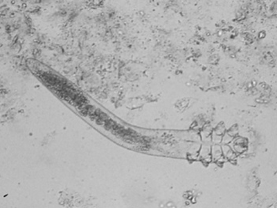 İnsan Follikül Maytları (Demodicidae)