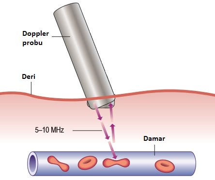 Ayaklarda Venöz Yetmezlikte, Varislerde ve Telenjektazilerde Ultrasound ve Doppler