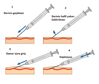 enjeksiyon 01