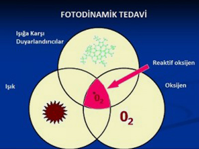 Damarsal Hastalıklarda Fotodinamik Tedavi