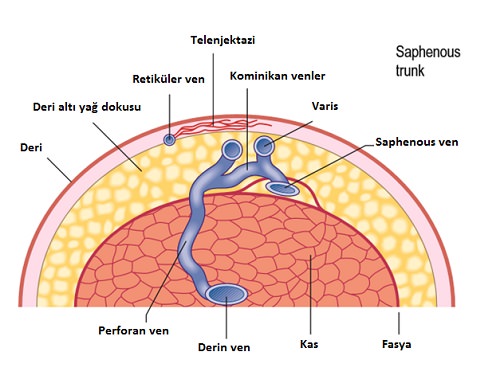 Telenjektazi