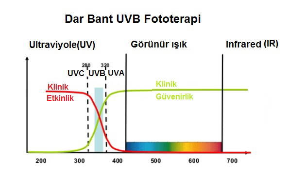 Cilt Çatlaklarında 308 Nm Excimer Tedavisi