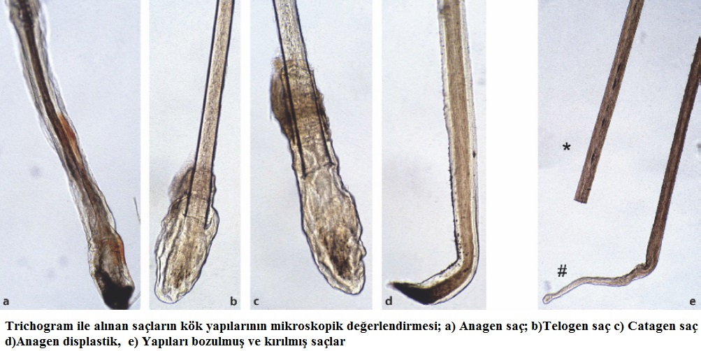 Trikogram Testi