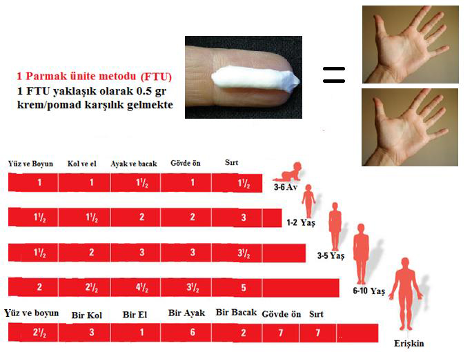 Atopik Egzamanın İlaçla Tedavisi