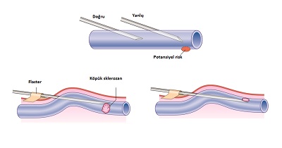 enjeksiyon-05.jpg