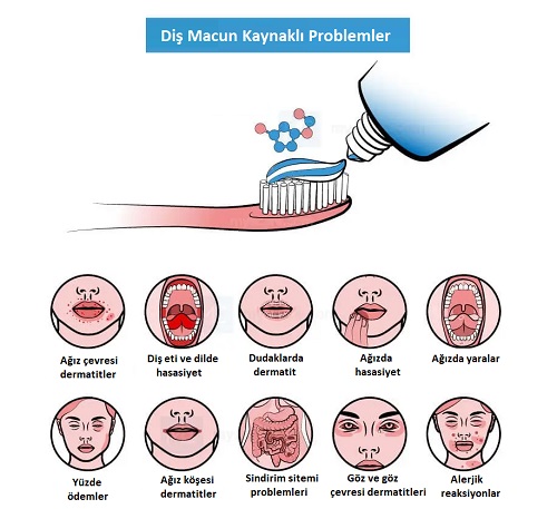 Diş Macunları ve Ağız Yaraları