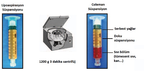 hucresel_tedavisvfadsc_jel_stromal_vaskuler_fraksiyon_yag_doku_kaynakli_kok_hucre_ciltyuz_genclestirme.jpg