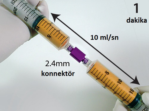 hucresel_tedavisvfadsc_jel_stromal_vaskuler_fraksiyon_yag_doku_kaynakli_kok_hucre_ciltyuz_genclestirme_2a.jpg