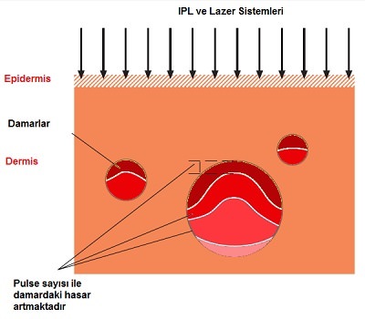 ipl-03.jpg