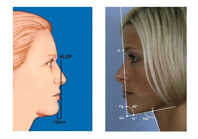 Boynun Anatomik Alanları ve Açılar