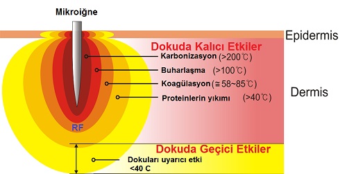 Liftron Defrax Klinik Kullanımı