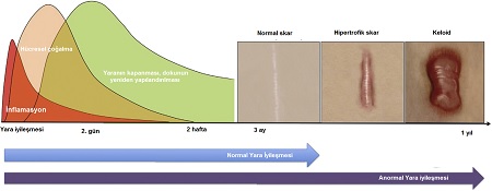 Ciltte Fizyolojik ve Patolojik Yara İyileşmesi 