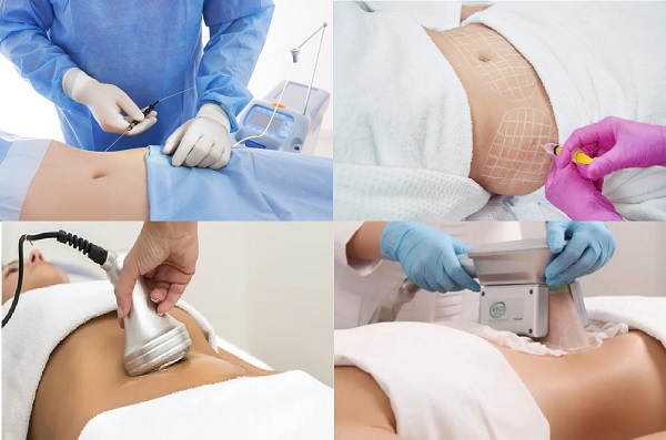 Lipolizis, Bölgesel Yağlanmanın Eritilmesi, Lipolizis Uygulamaları