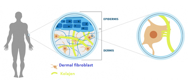 Otolog Fibroblast Hücre Tedavisi (Fibrocell)