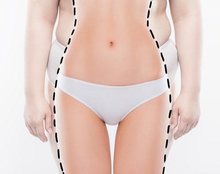 Lazer Lipolizis Uygulama Alanları