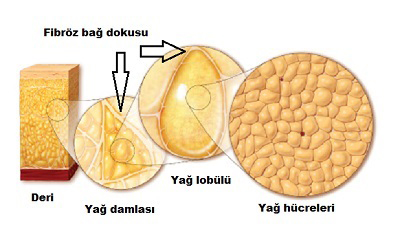 yag dokusu 01