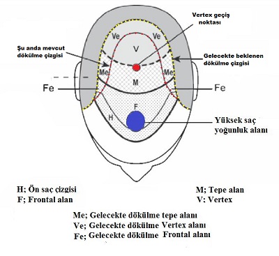 Saçların Ekileceği Alanın Değerlendirilmesi