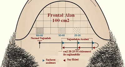 Saç Ekim Alanının ve Ekilecek Saç Sayısının Hesaplanması