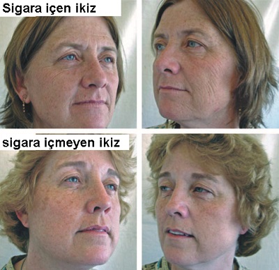sigara-yuz-2.jpg