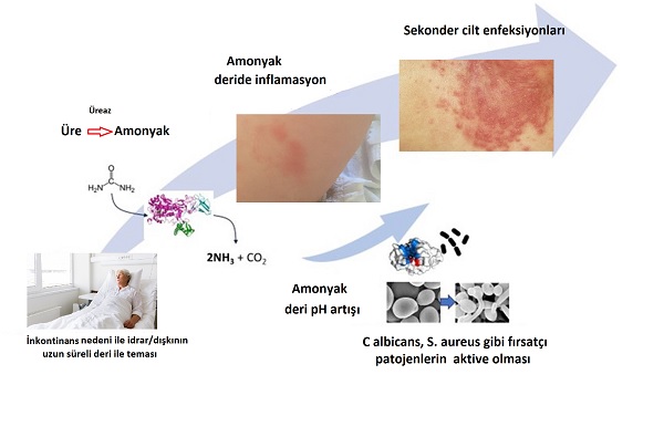 Yetişkin Bez Egzamaları, İnkontinans İlişkili Dermatitler, Nedenleri