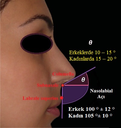 nasolabial aci