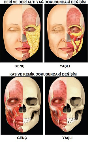 Yüz İmaj Estetiği, Yüz İfade Estetiği