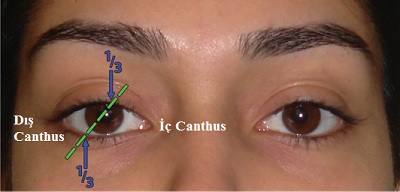 Yüzde Göz ve Göz Kapaklarının Estetik Analizi