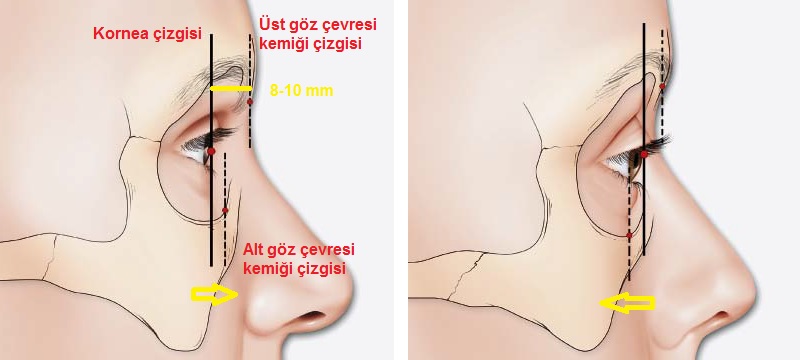 Yüzde Göz ve Göz Kapaklarının Estetik Analizi