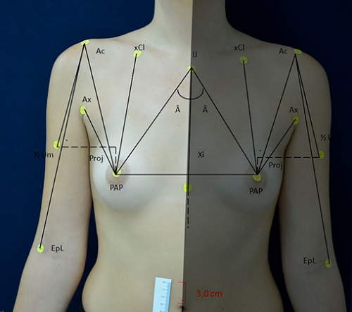 Estetik ve Simetrik Göğüslerde Klinik Fotoğraf Değerlendirilmesi