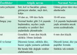 Atipik nevusler ile normal nevusler arasındaki farklar yandaki tabloda özetlenmiştir.