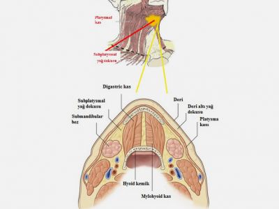 Çene altı ve Boyun Yağ Dokusu
